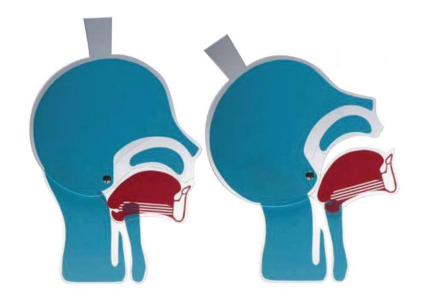 Modèle anatomique de tête en coupe pour formation aux voies aériennes.